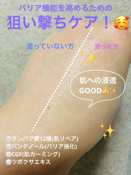 パンテセルリペアシカコンセントレートバーム/BIOHEAL BOH/フェイスバームを使ったクチコミ(5枚目)