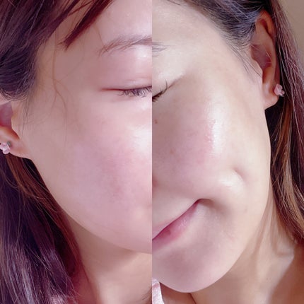 ルミエール ヴァイタルC/FEMMUE/ブースター・導入液を使ったクチコミ(3枚目)