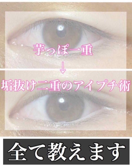 リアルタンク|mejutu(目術)の口コミ - この涙袋テープは リアルタンク|mejutu(目術)の口コミ - この涙袋テープは