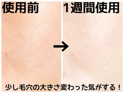 エクソソームシカ アンプル/MEDICUBE/美容液を使ったクチコミ(3枚目)