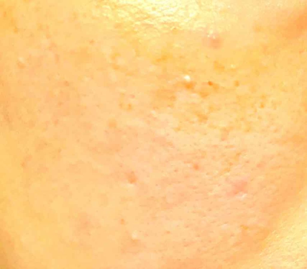 スキントリートメント ファンデーション/ナチュラグラッセ/リキッドファンデーションを使ったクチコミ(3枚目)