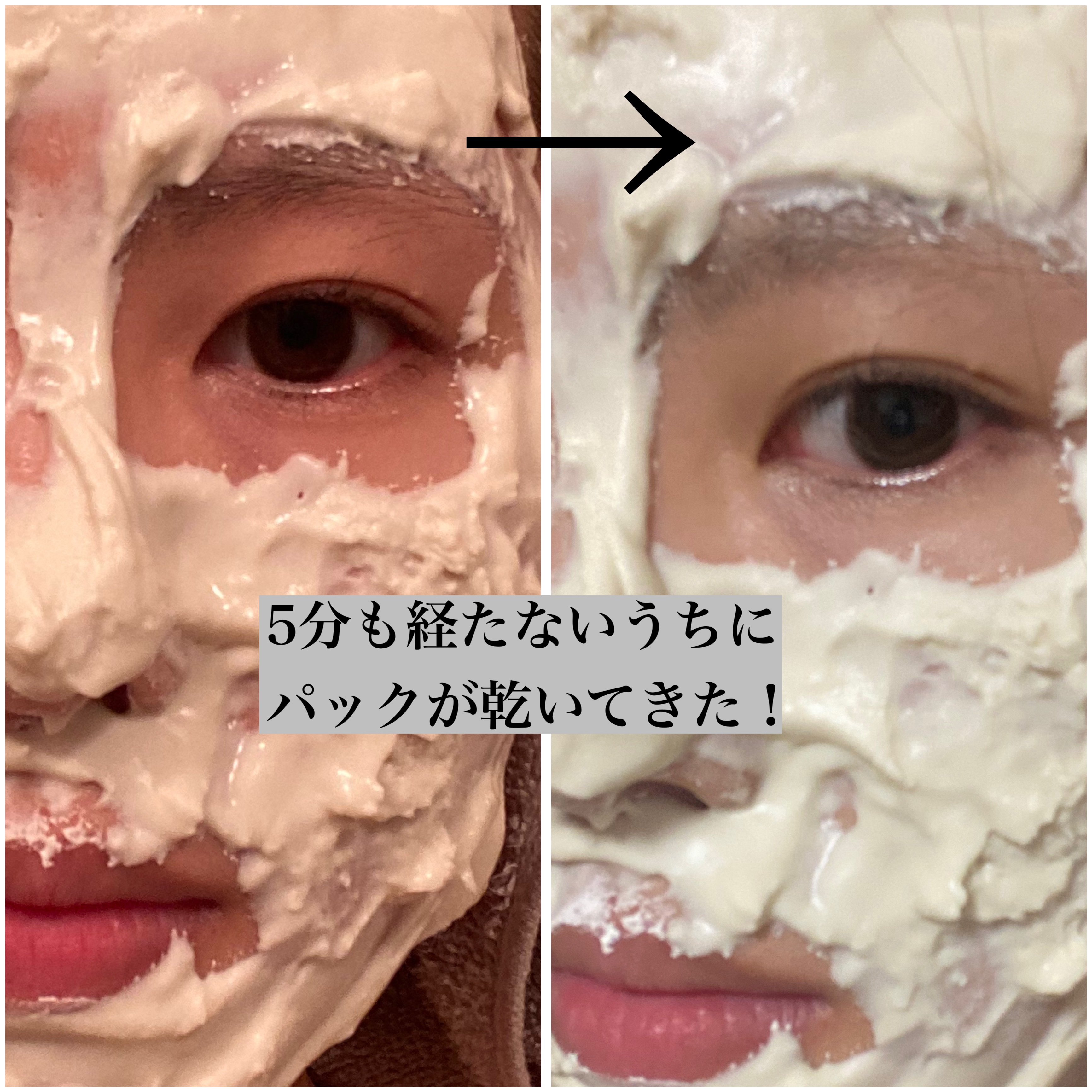 リードルショットEX  ビタミンモデリングパック/VT/シートマスク・パックを使ったクチコミ（3枚目）