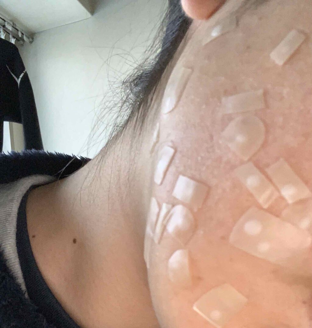 キズパワーパッド/バンドエイド/その他を使ったクチコミ(2枚目)