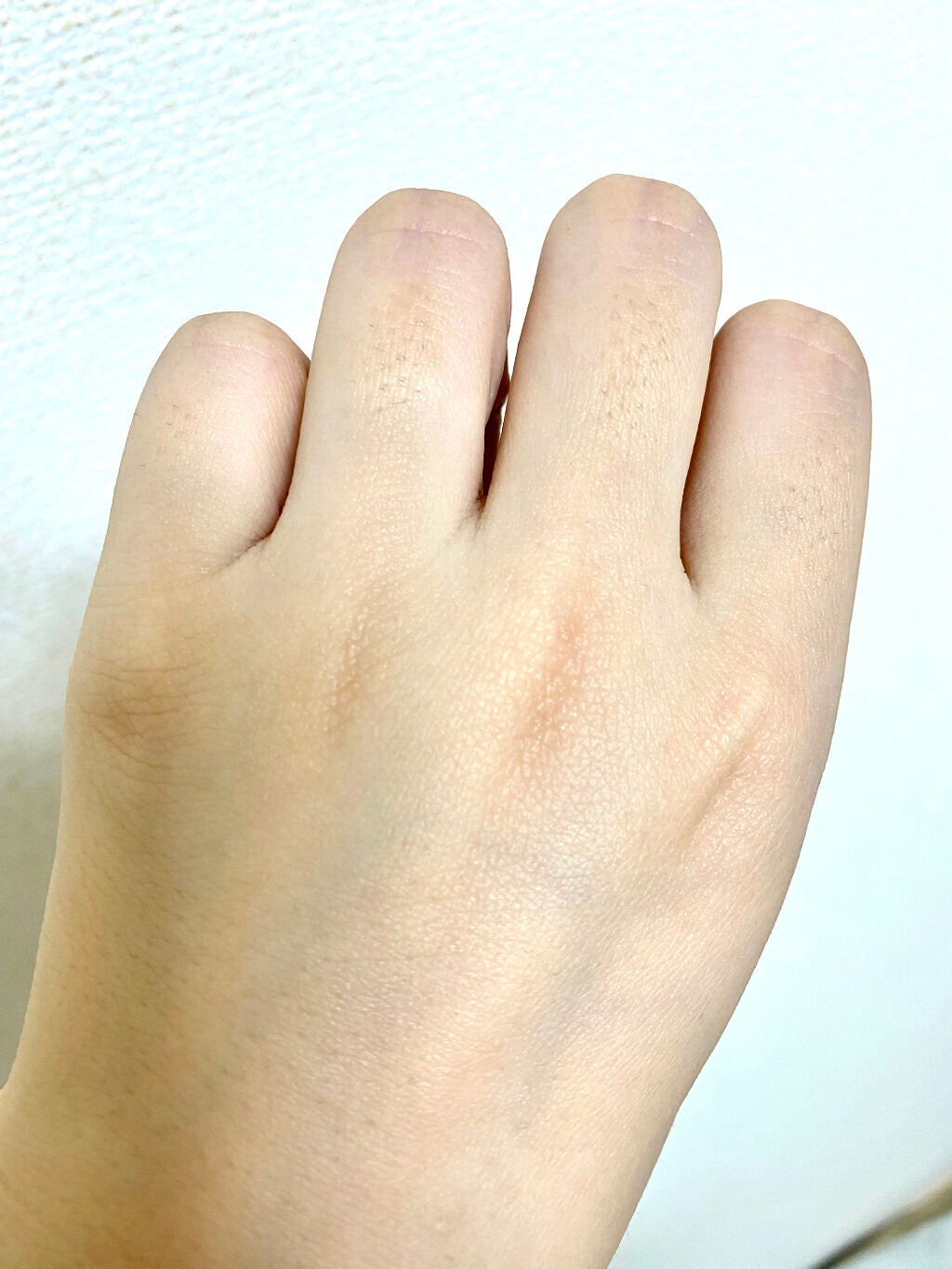 アイスレディ/icelady/家庭用脱毛器を使ったクチコミ(3枚目)