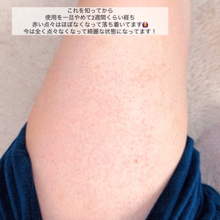 ジョンソン ベビーオイル 無香料/ジョンソンベビー/ボディオイルを使ったクチコミ(7枚目)