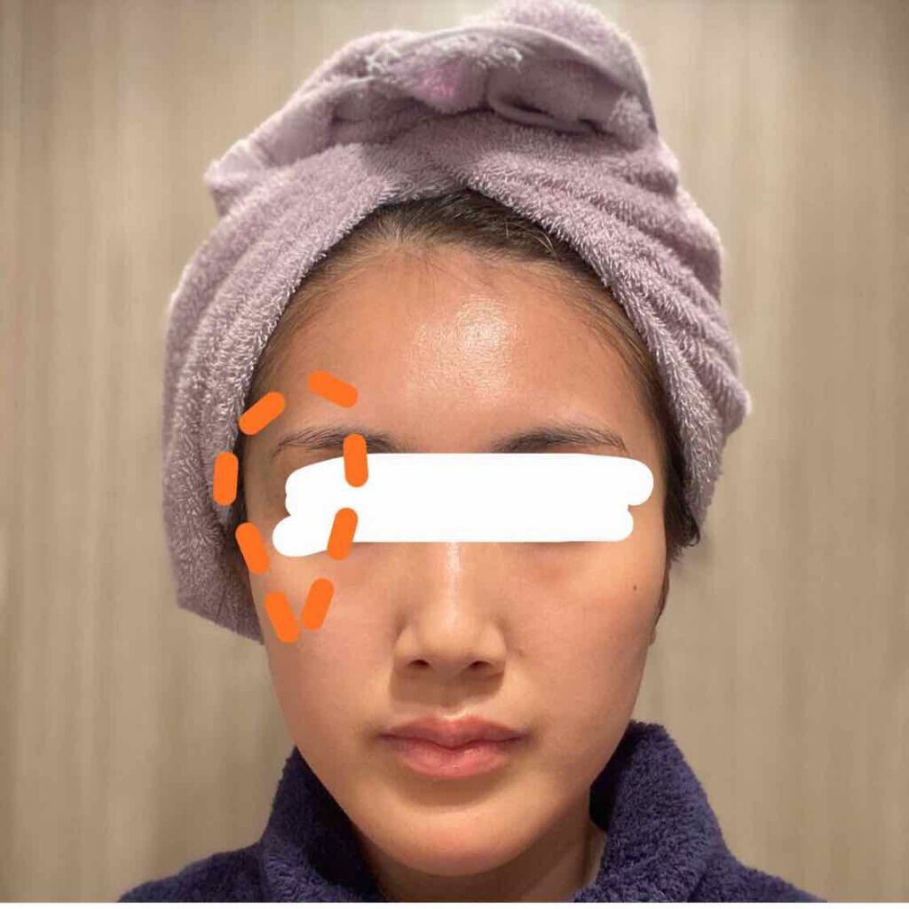 I.P.IライトマックスAPマスクEX/MEDIHEAL/シートマスク・パックを使ったクチコミ（1枚目）