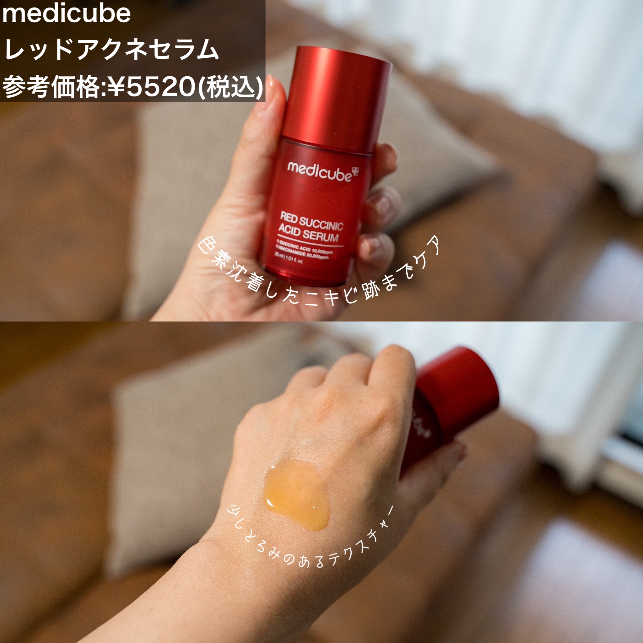 レッドアクネピーリングセラム/MEDICUBE/美容液を使ったクチコミ（2枚目）