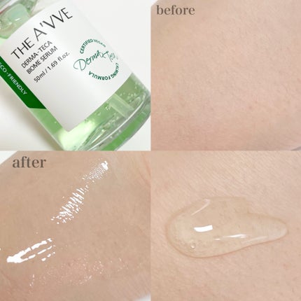 ダーマテカバイオームセラム/THE A'VVE/美容液を使ったクチコミ(3枚目)