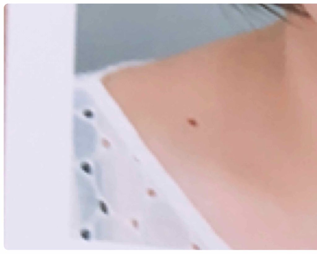 Nexcare/3M nexcare/にきびパッチを使ったクチコミ(2枚目)