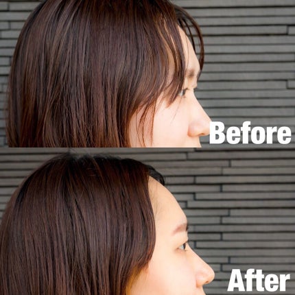 ミラクルズ グロッシー シェイク アクアオイル/パンテーン/ヘアオイルを使ったクチコミ(2枚目)