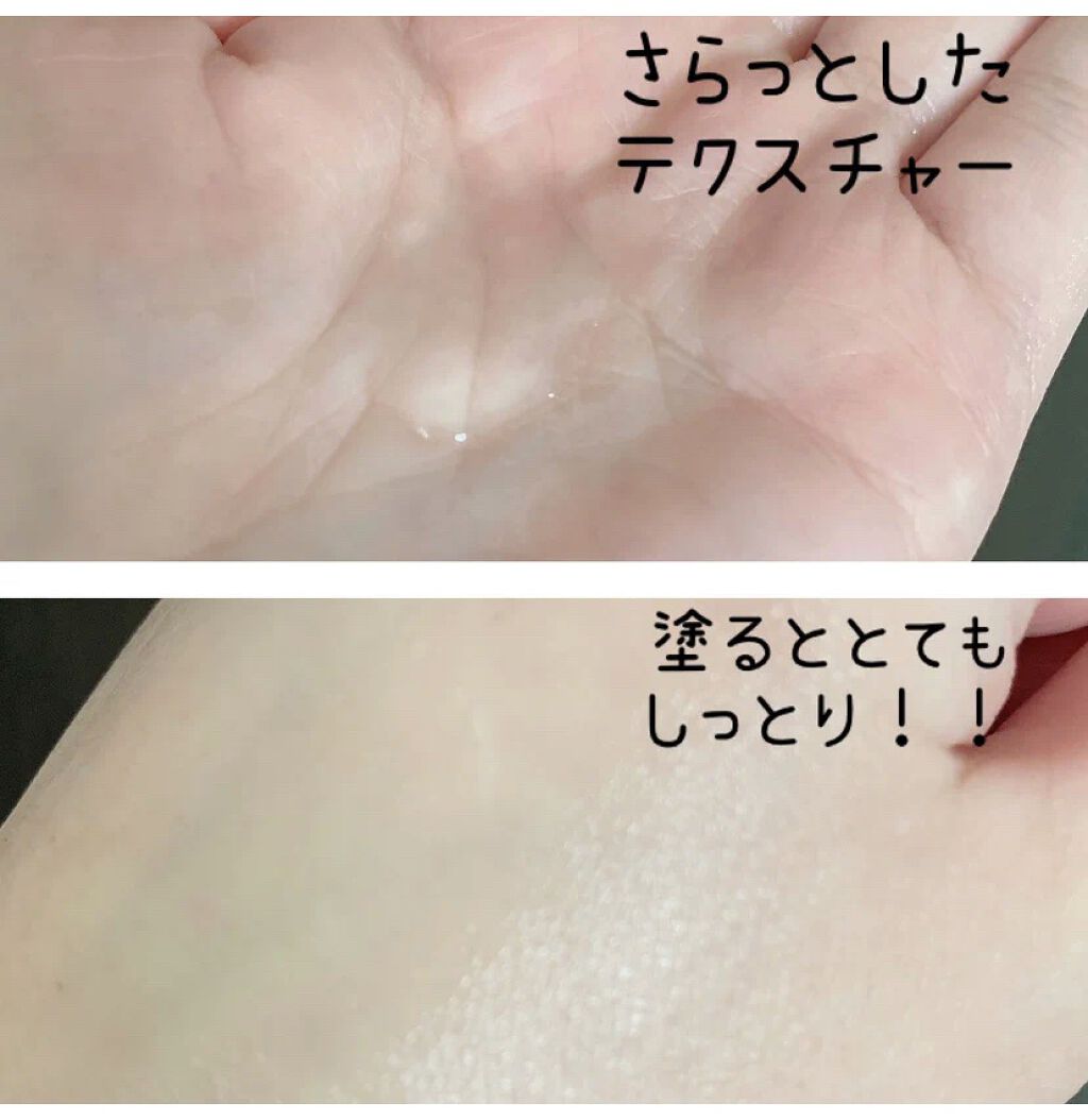 ピンクティーツリートナー/APLIN/化粧水を使ったクチコミ（3枚目）