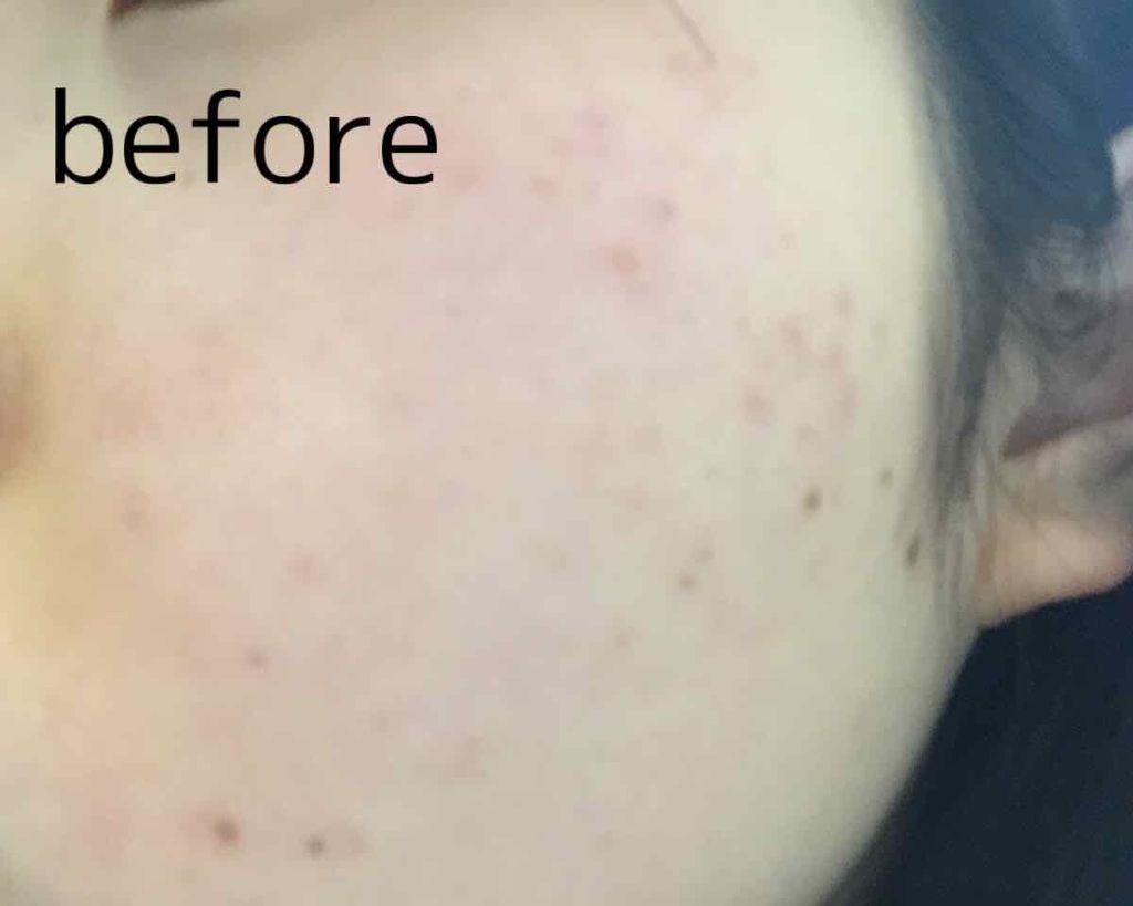 白潤 薬用美白乳液/肌ラボ/乳液を使ったクチコミ（2枚目）