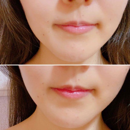 リップトリートメントバーム ピュアレッド/ISOI/リップバームを使ったクチコミ(4枚目)