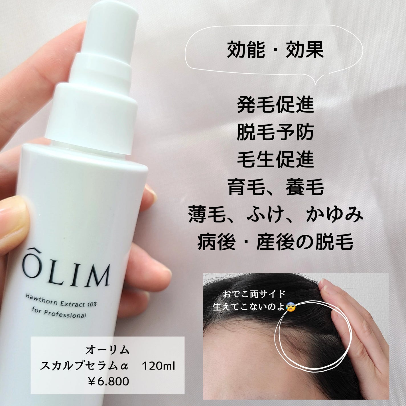 オーリム 育毛剤/OLIM/頭皮ローションを使ったクチコミ(2枚目)