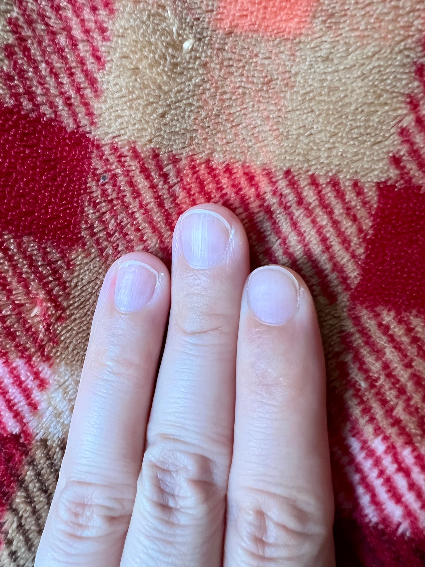 Mimits モイストネイルオイル/ビー・エヌ/ネイルオイル・トリートメントを使ったクチコミ(5枚目)