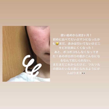 ここみ on LIPS 「お久しぶりです！最近投稿できてなくてすみません。ちょっとお肌が..」（2枚目）