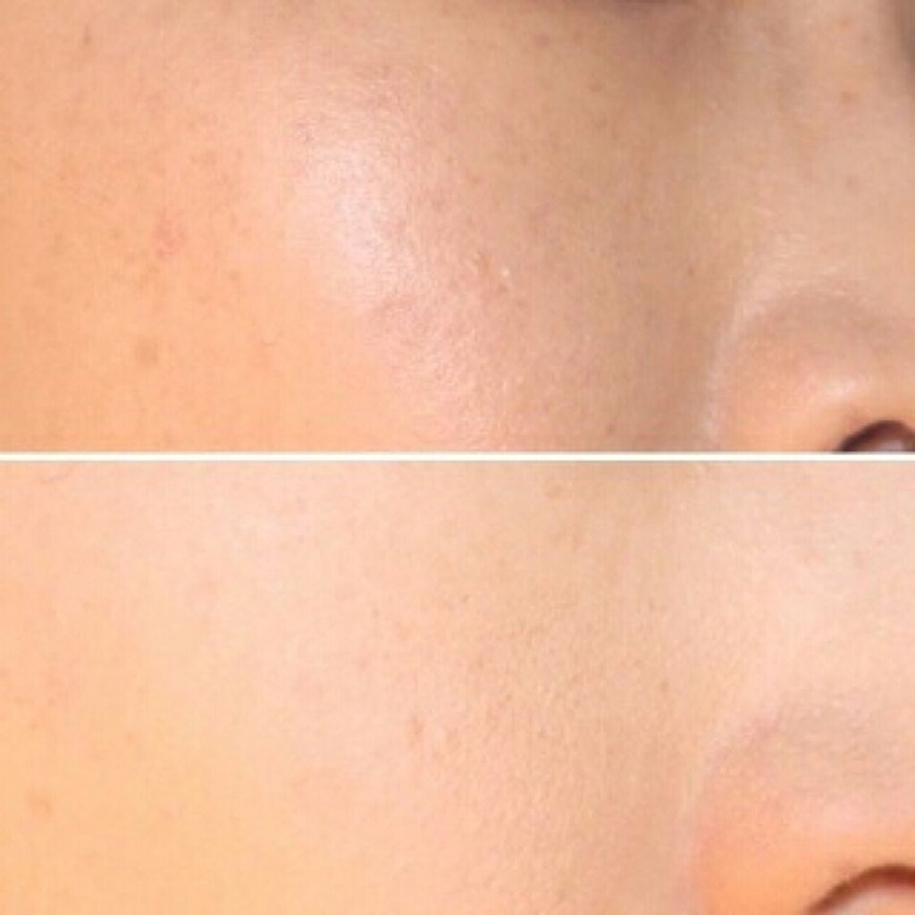 UVクリアフェイスパウダー/CEZANNE/プレストパウダーを使ったクチコミ（1枚目）