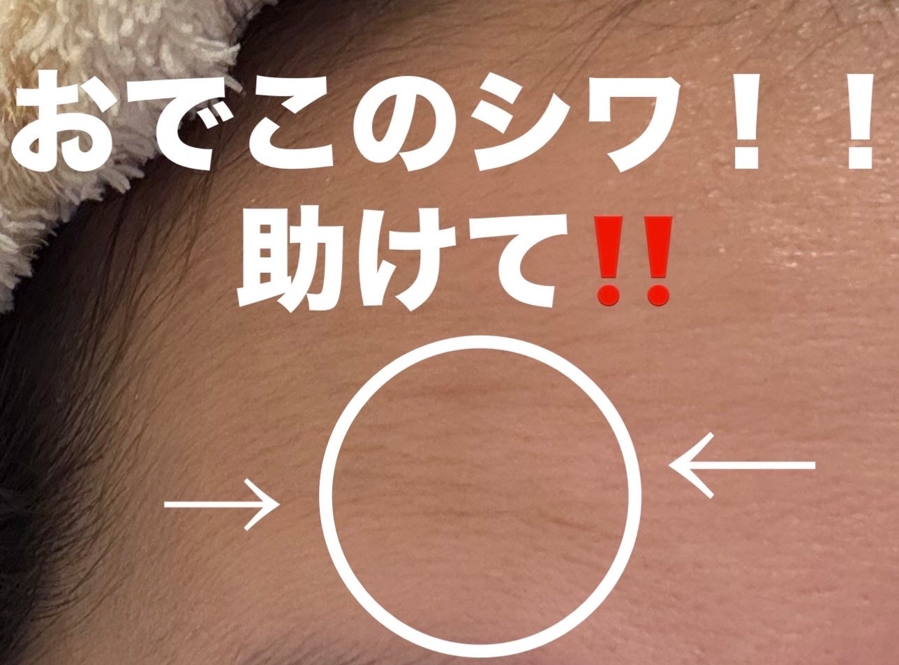 おでこでシワ取りパッチ/その他を使ったクチコミ(1枚目)