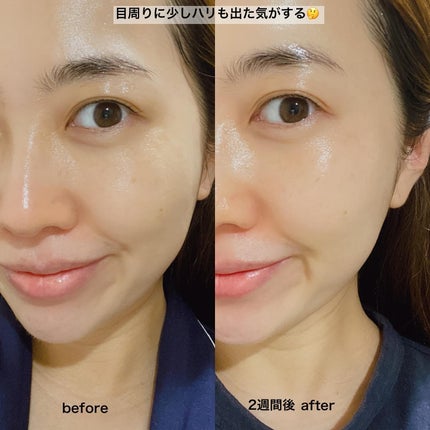 Retin A アンチ リンクル3Dクリーム/theralogic/フェイスクリームを使ったクチコミ(5枚目)