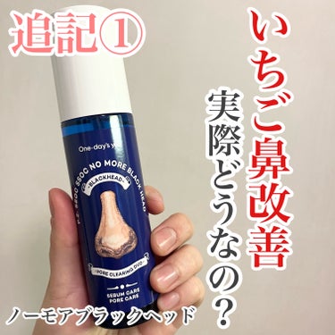 追記(2024.4.28)

更に使っていく感じ、鼻の頭はコットンが貼りやすいため黒ずみの改善が顕著に現れてきました！
小鼻のあたりや、コットンが剥がれやすい場所はまだまだ残ってます。
でも正面から見た