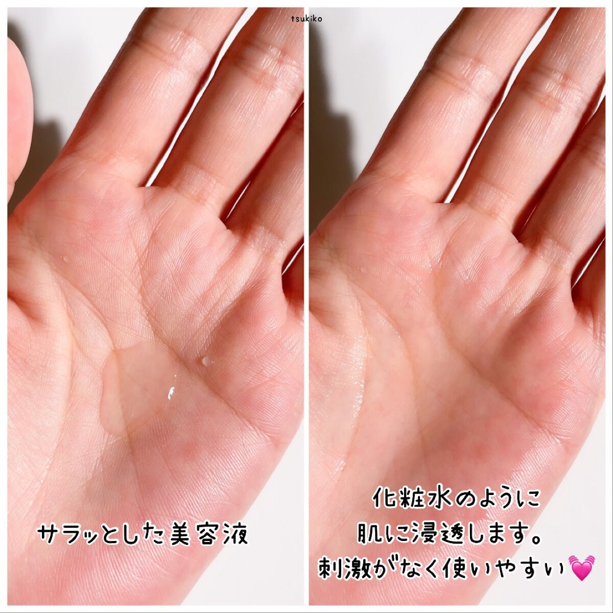 レチノール配合美容液 レチノール20/Celife/美容液を使ったクチコミ(4枚目)