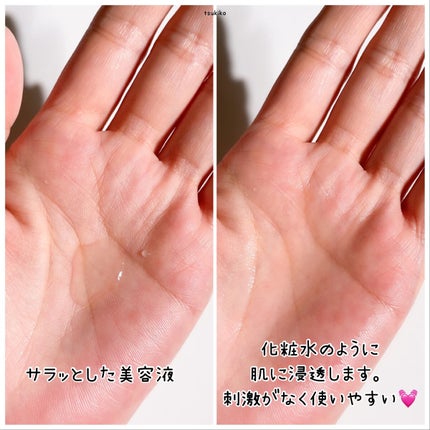 レチノール配合美容液 レチノール20/Celife/美容液を使ったクチコミ(4枚目)