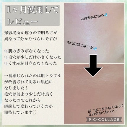 CICA デイリースージングマスク/VT/シートマスク・パックを使ったクチコミ(6枚目)