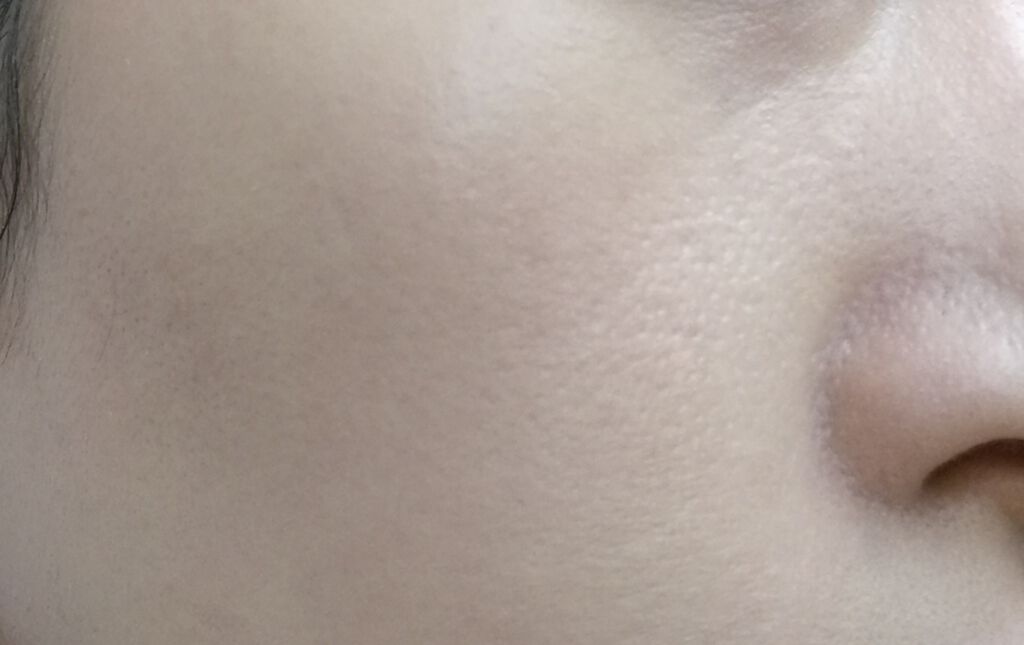 ドクタージャルト シカペア リカバー (第2世代）/Dr.Jart＋/フェイスクリームを使ったクチコミ（2枚目）