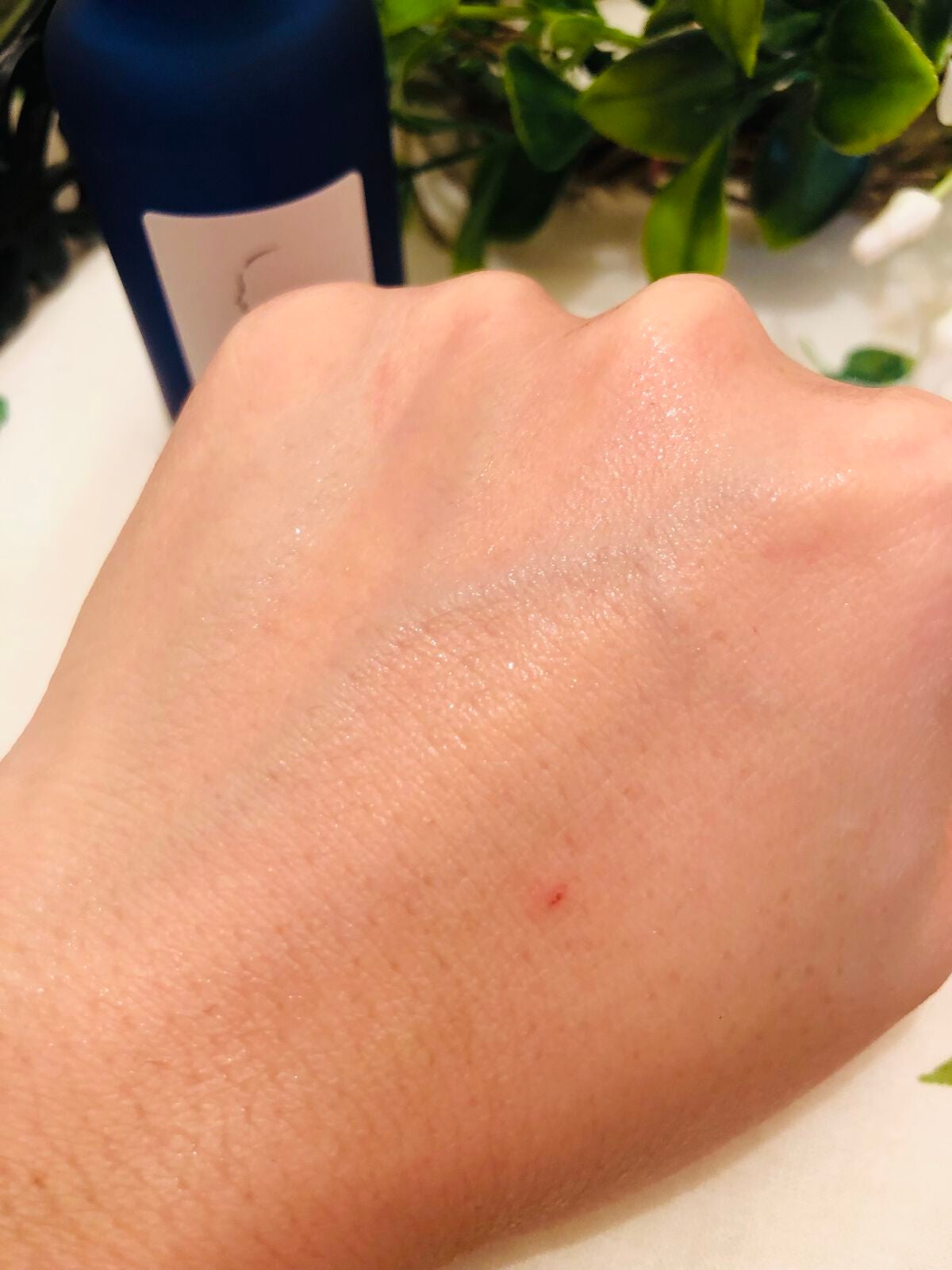 タカミスキンピール/タカミ/ブースター・導入液を使ったクチコミ(5枚目)