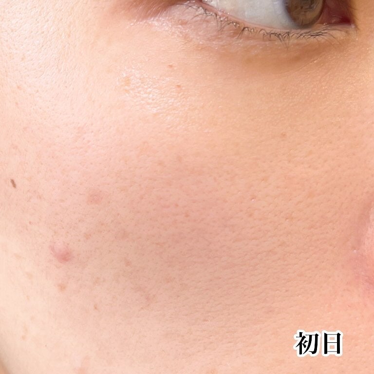 キューブマスク レチノール/ネイチャーリパブリック/シートマスク・パックを使ったクチコミ(6枚目)