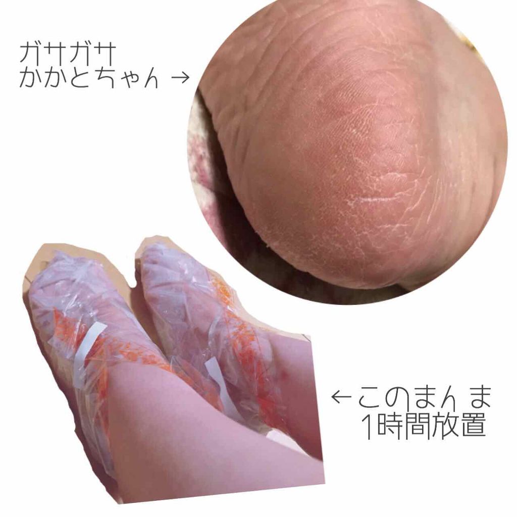 足裏角質パック ティアラローズの香り/EVERYYOU/レッグ・フットケアを使ったクチコミ(3枚目)