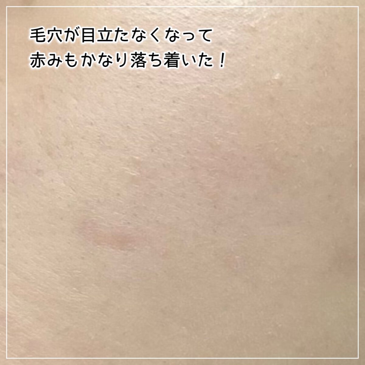 レチノールインテンシブ アドバンスドトリプルアクションアイクリーム/SOME BY MI/アイケア・アイクリームを使ったクチコミ(8枚目)