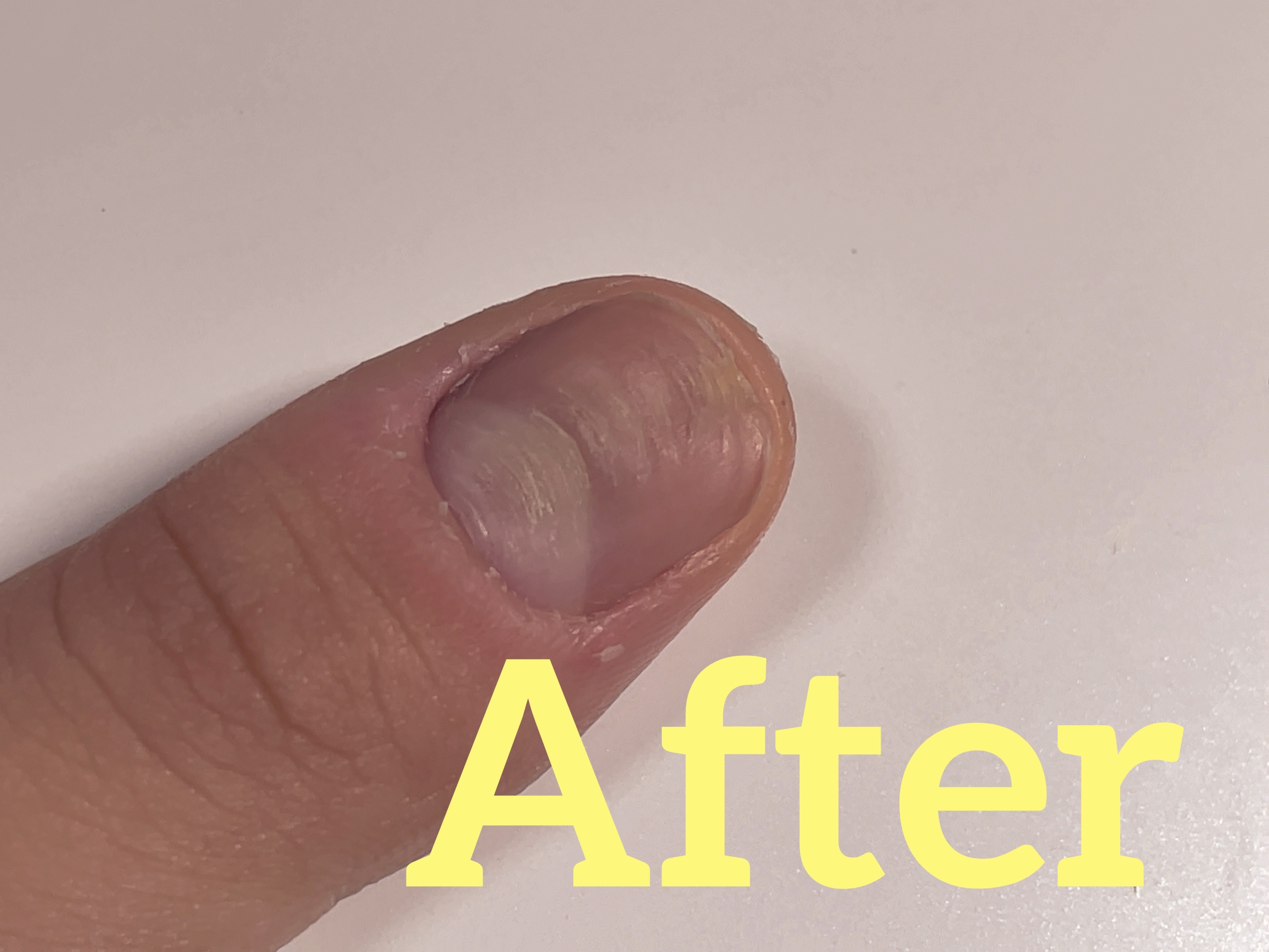 ディープセラム/Dr.Nail/ネイルオイル・トリートメントを使ったクチコミ（2枚目）