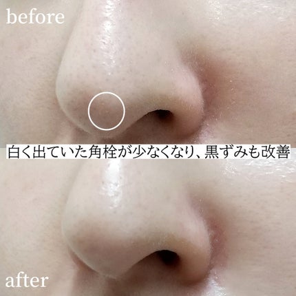 ソフィーナ iP ポア クリアリング ジェル ウォッシュ/SOFINA iP/その他洗顔料を使ったクチコミ(4枚目)