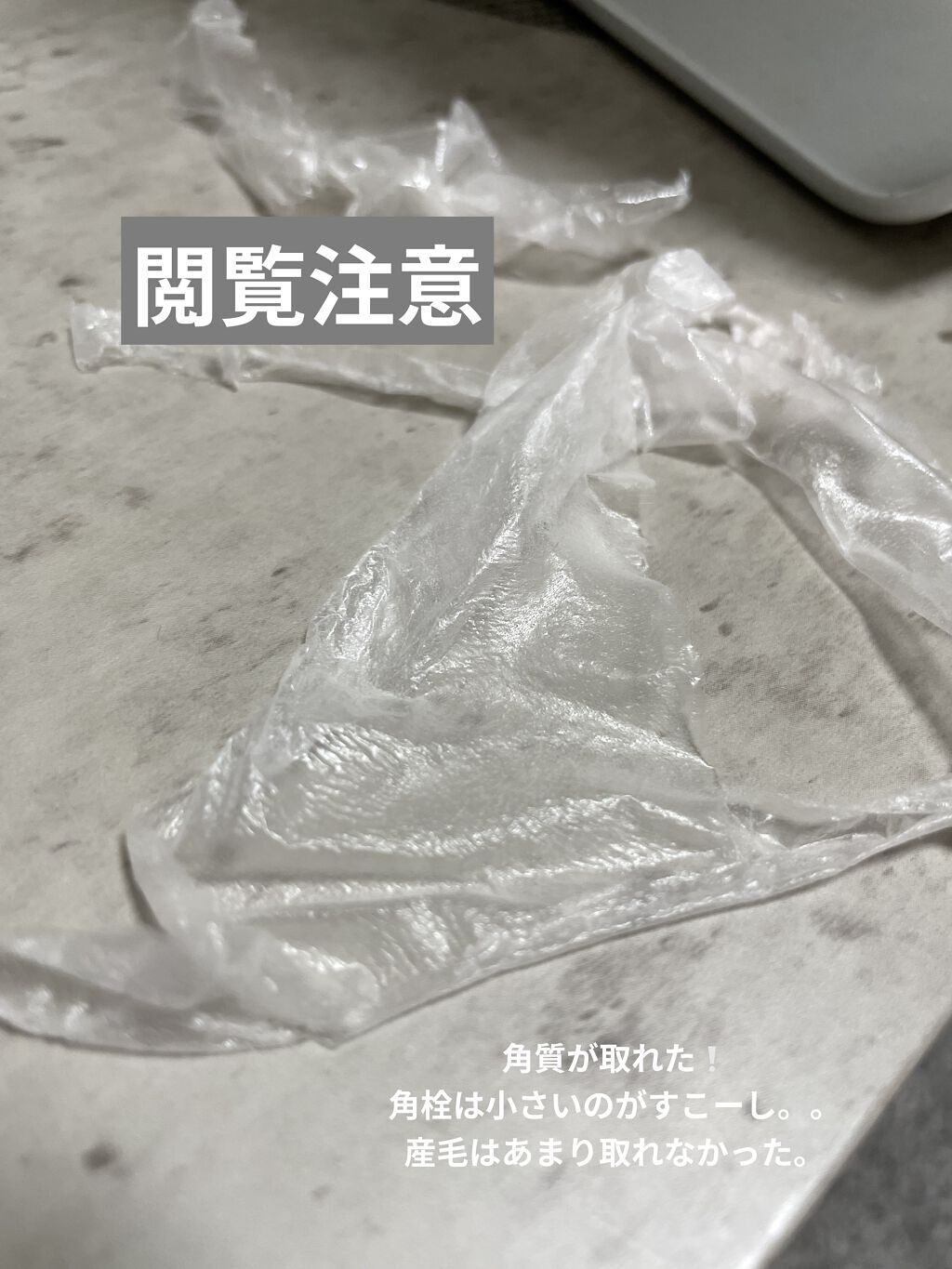 ももぷり フレッシュピールオフパック/ももぷり/ピーリングを使ったクチコミ（3枚目）