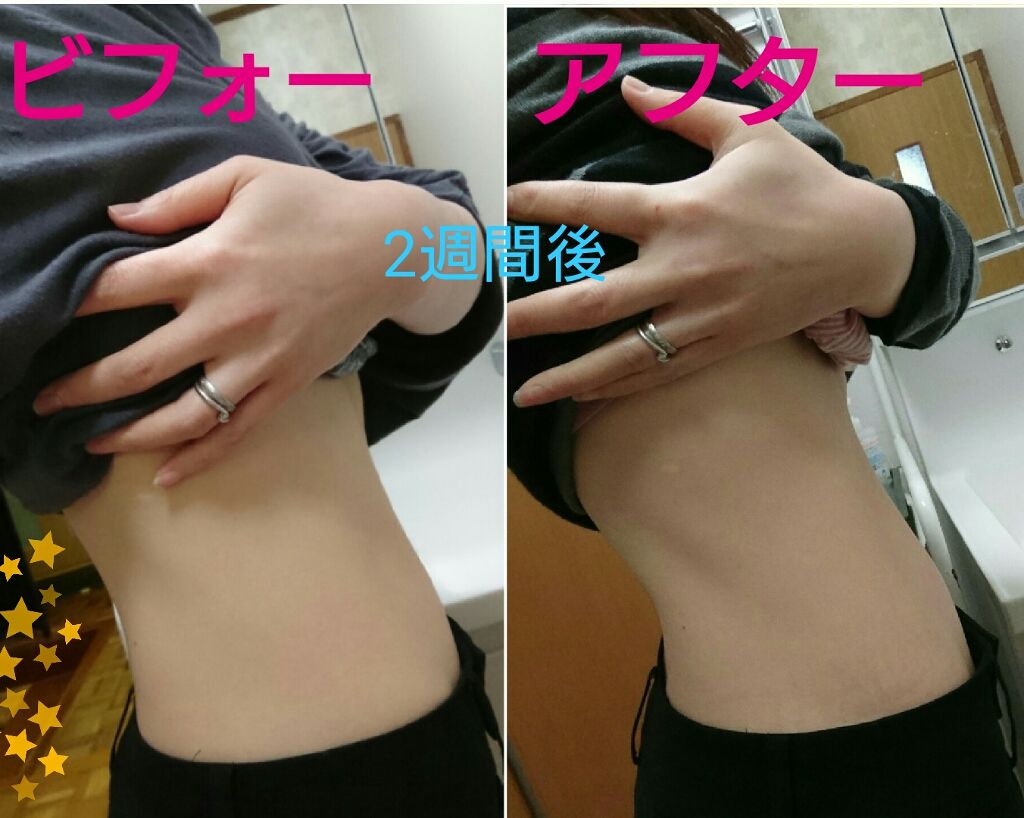 もち麦ごはん/はくばく/食品を使ったクチコミ（2枚目）