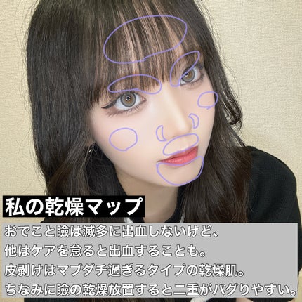 ヒルマイルドクリーム(医薬品)/健栄製薬/その他を使ったクチコミ(2枚目)