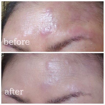 タンイドル ウルトラ ウェア リキッド/LANCOME/リキッドファンデーションを使ったクチコミ(2枚目)