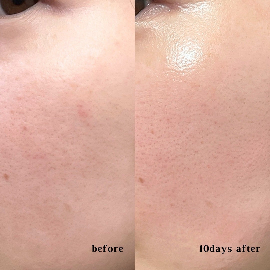 PDRNショット675/COSNORI/美容液を使ったクチコミ(4枚目)