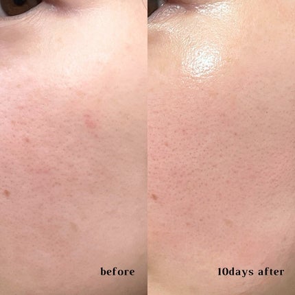 PDRNショット675/COSNORI/美容液を使ったクチコミ(4枚目)