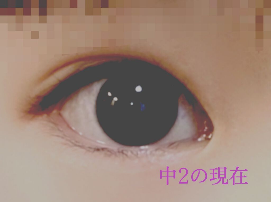 アイテープ 埋没式両面テープ/DAISO/二重まぶた用アイテムを使ったクチコミ（3枚目）