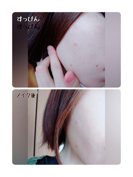 ゼロスポットパッチ/Today’s Cosme/にきびパッチを使ったクチコミ(4枚目)