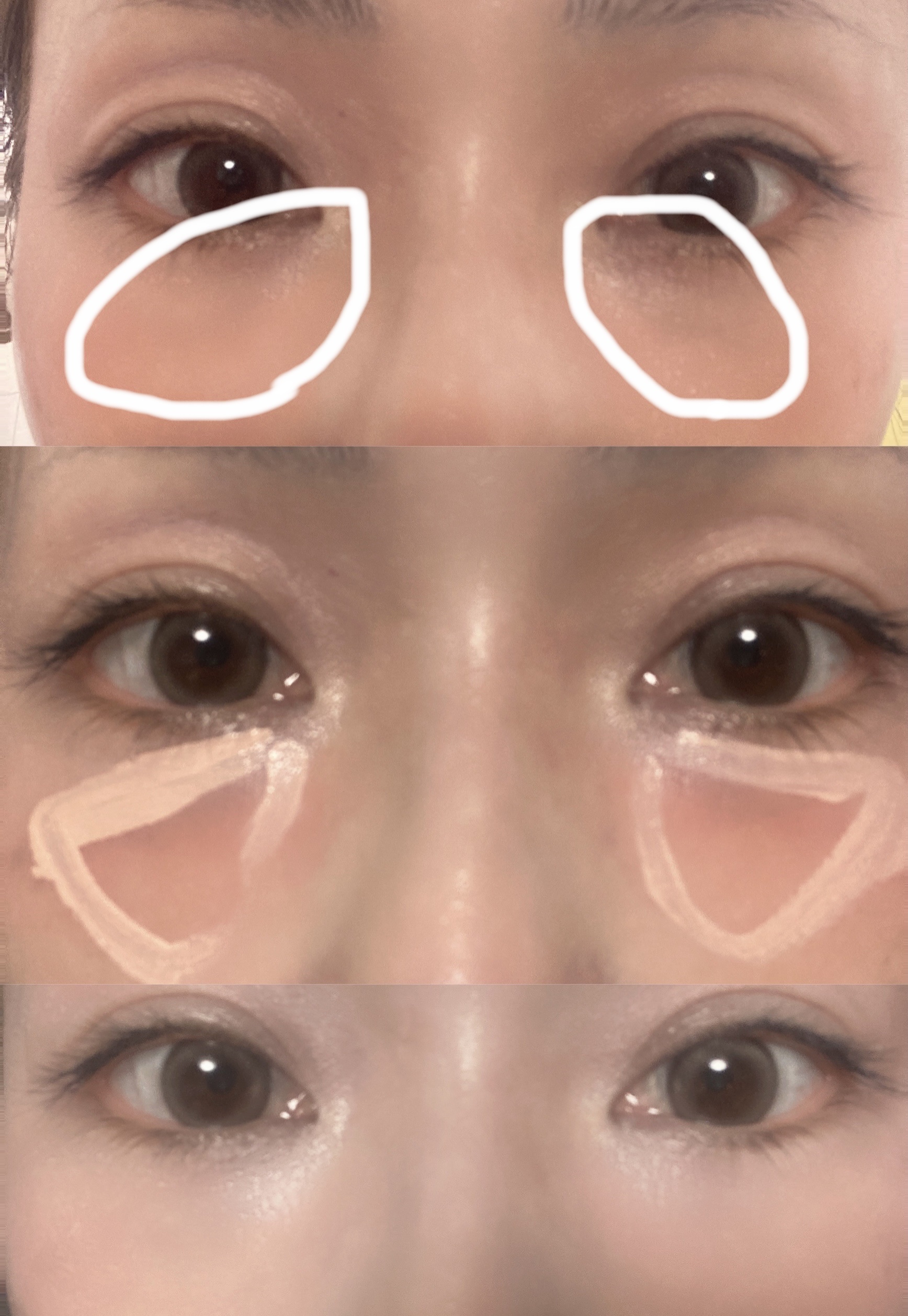 ロングラスティングチップコンシーラー/LUNA/リキッドコンシーラーを使ったクチコミ（2枚目）