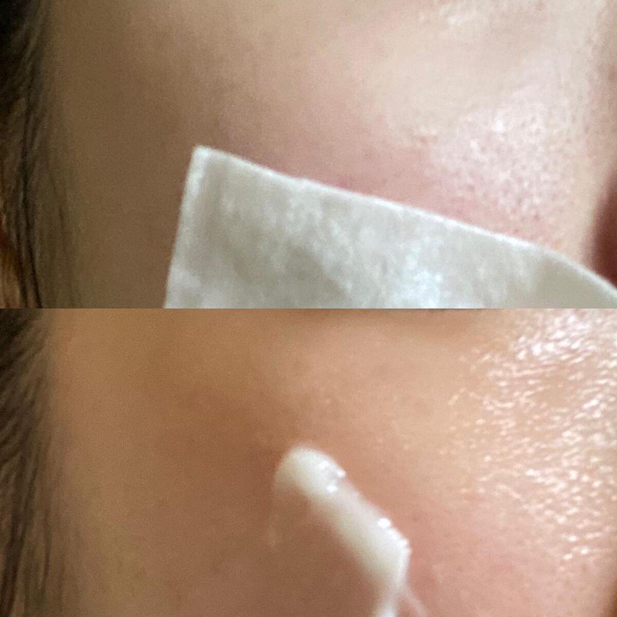 AHA·BHA·PHA 30デイズミラクルトナー/SOME BY MI/化粧水を使ったクチコミ(7枚目)