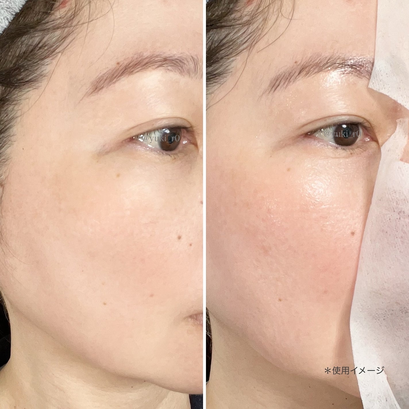 グルタシカ ブライトニングクイックマスク/Dr.Viuum/シートマスク・パックを使ったクチコミ(5枚目)