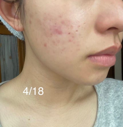 エクストラマイルドスキンローションI/ニュースキン/化粧水を使ったクチコミ(2枚目)