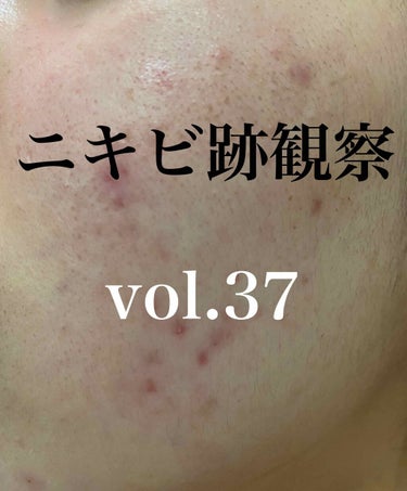 敏感肌用薬用美白美容液/無印良品/美容液を使ったクチコミ（1枚目）