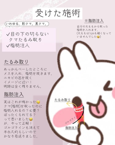 ぴーちゃん🧡 on LIPS 「クマ取り体験談/┈┈┈┈┈┈┈┈┈┈ストーリーズにダウンタイム..」（4枚目）