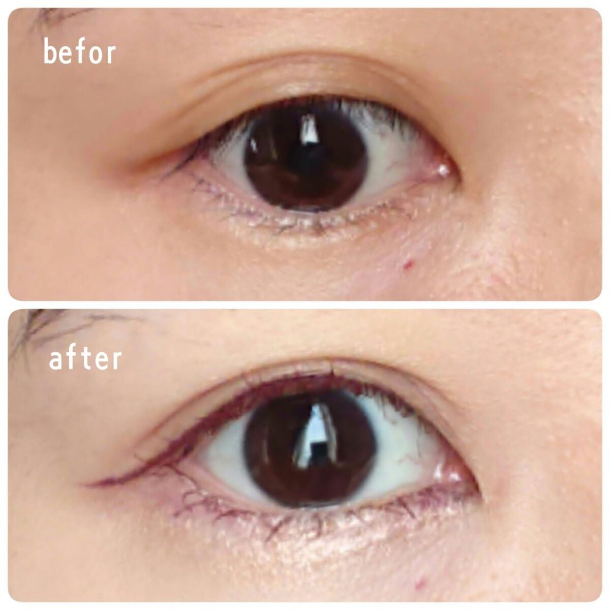 ããŒãã§ã¯ããšã¯ã¹ãã³ã·ã§ã³ ãã¹ã«ã© for ã«ãŒã«/D-UP/ãã¹ã«ã©ã䜿ã£ãã¯ãã³ãïŒ2æç®ïŒ