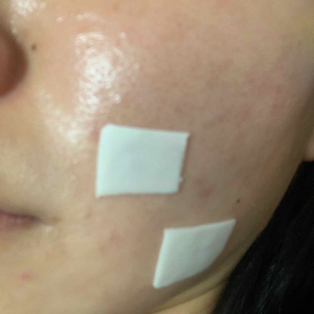 エピデュオゲル/マルホ株式会社/その他を使ったクチコミ（1枚目）